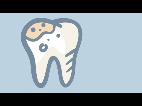 Black Otturazioni: La Rivoluzionaria Classe che Sta Trasformando il Mondo Dentale